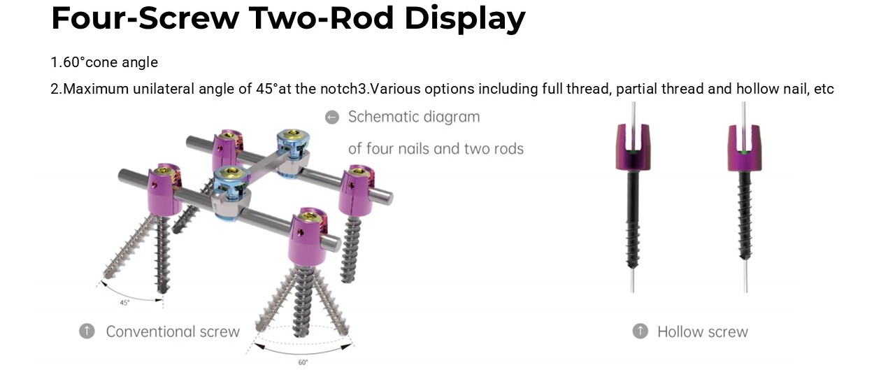 Occipital Plate - OCT System Components