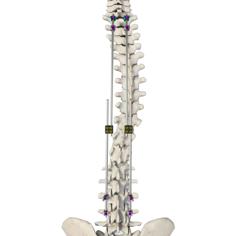 CoCrMo Thoracolumbar Posterior Screw-Rod System 6.0