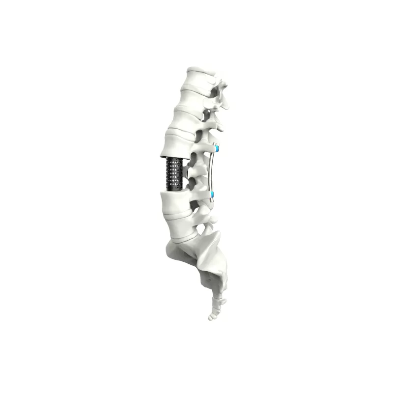 Titanium Mesh Cage