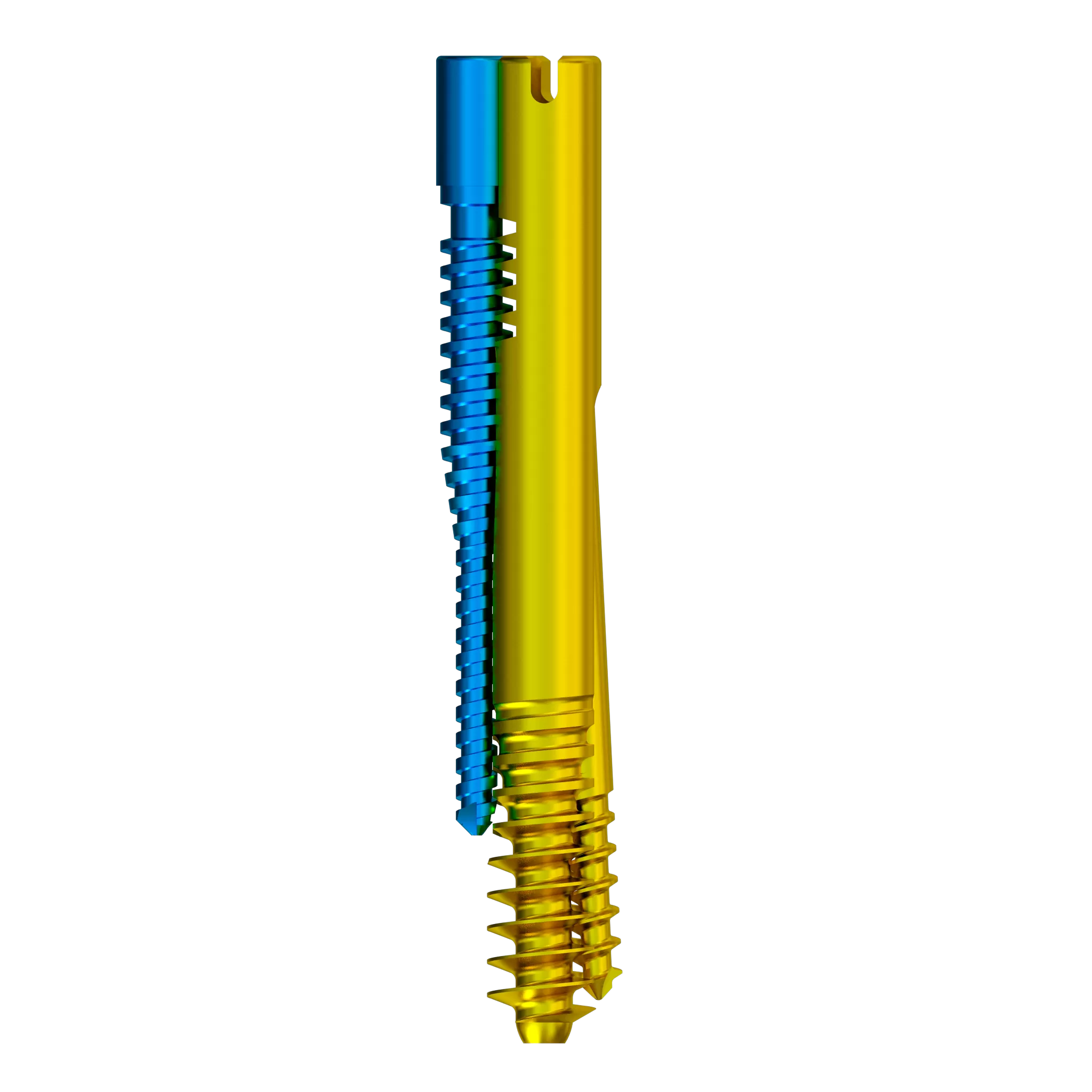 orthopedic implant, intramedllary nail, intramedllary nailing, im nail, im nailing, PFNA