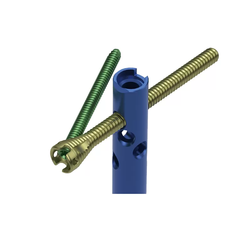 orthopedic implant, intramedllary nail, intramedllary nailing, im nail, im nailing, PFNA