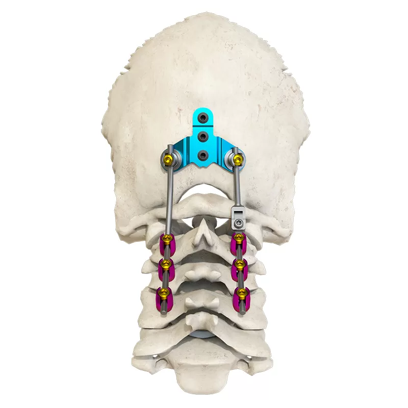 Posterior occipital-cervical-thoracic spinal system