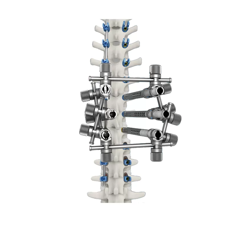 Spinal Deformity Correction