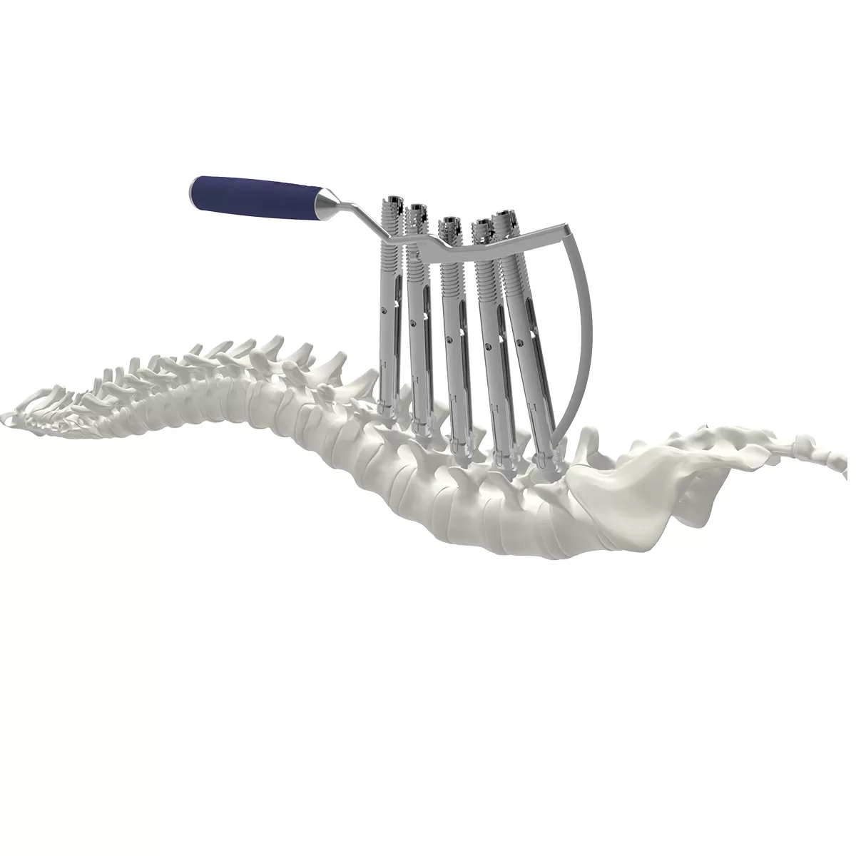 T-handle