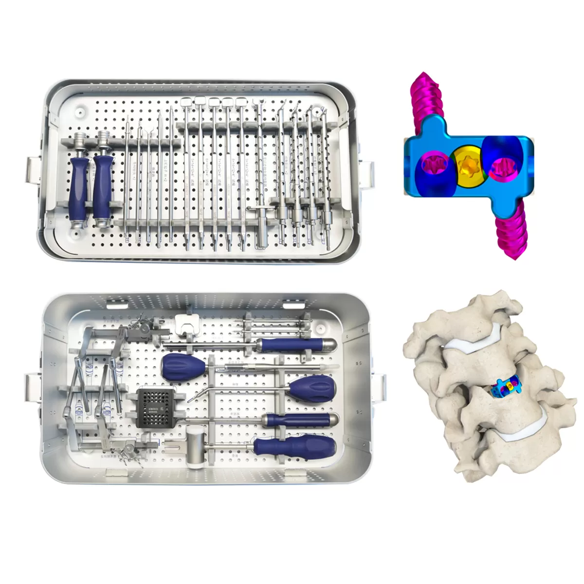 Zero-Profile Cage Holder