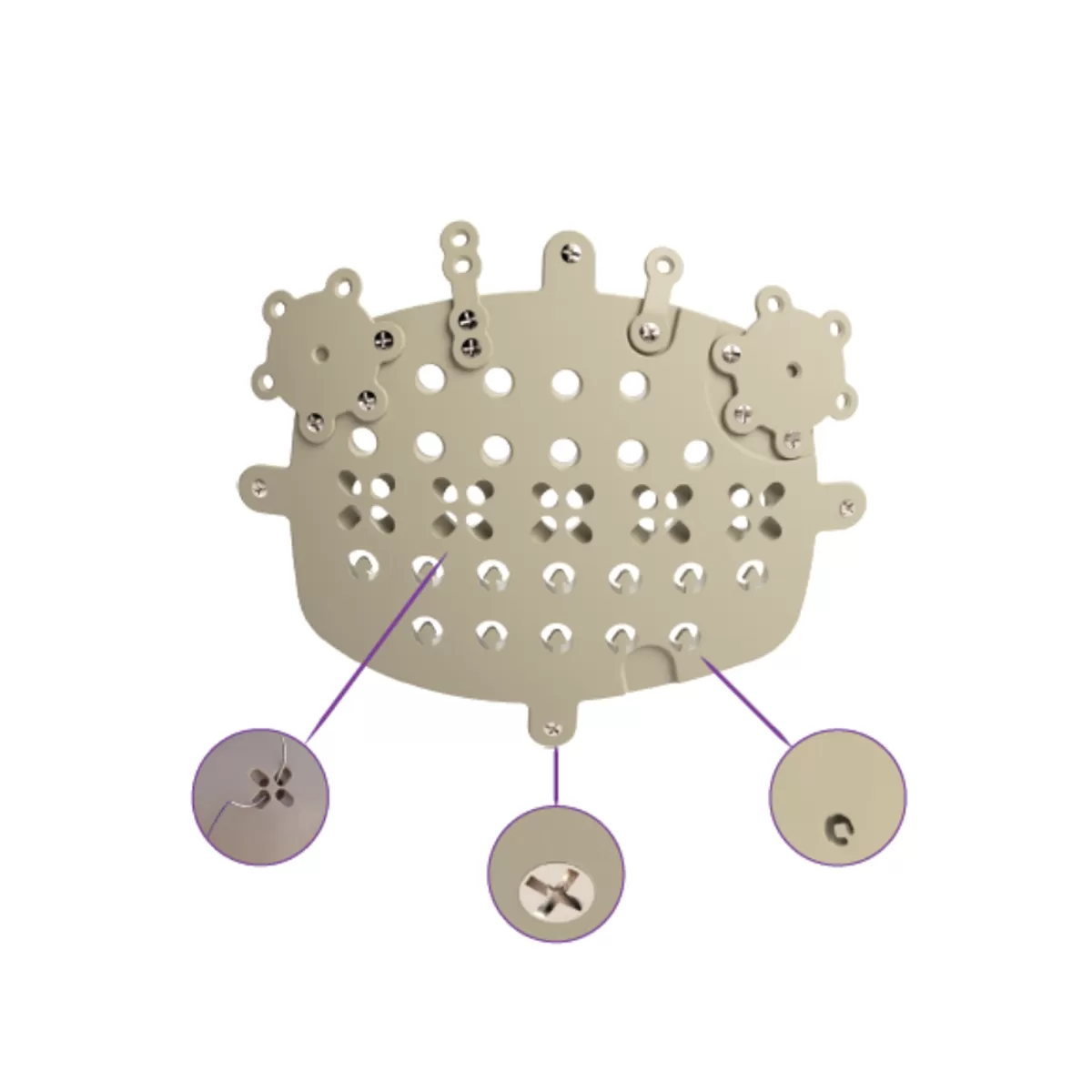 Personalized Customized Cranioplasty Solutions
