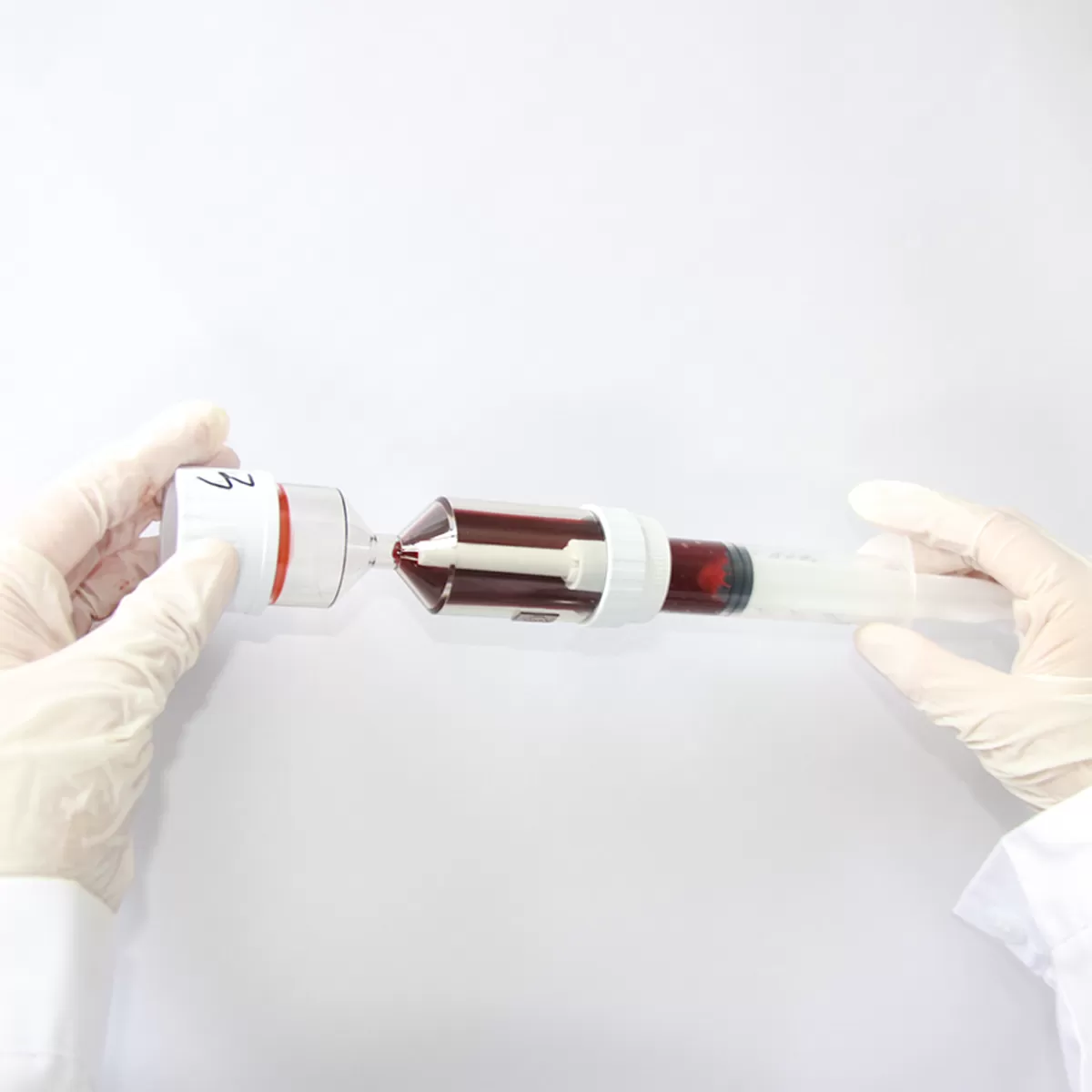 Platelet-Rich Plasma (PRP) Preparation System