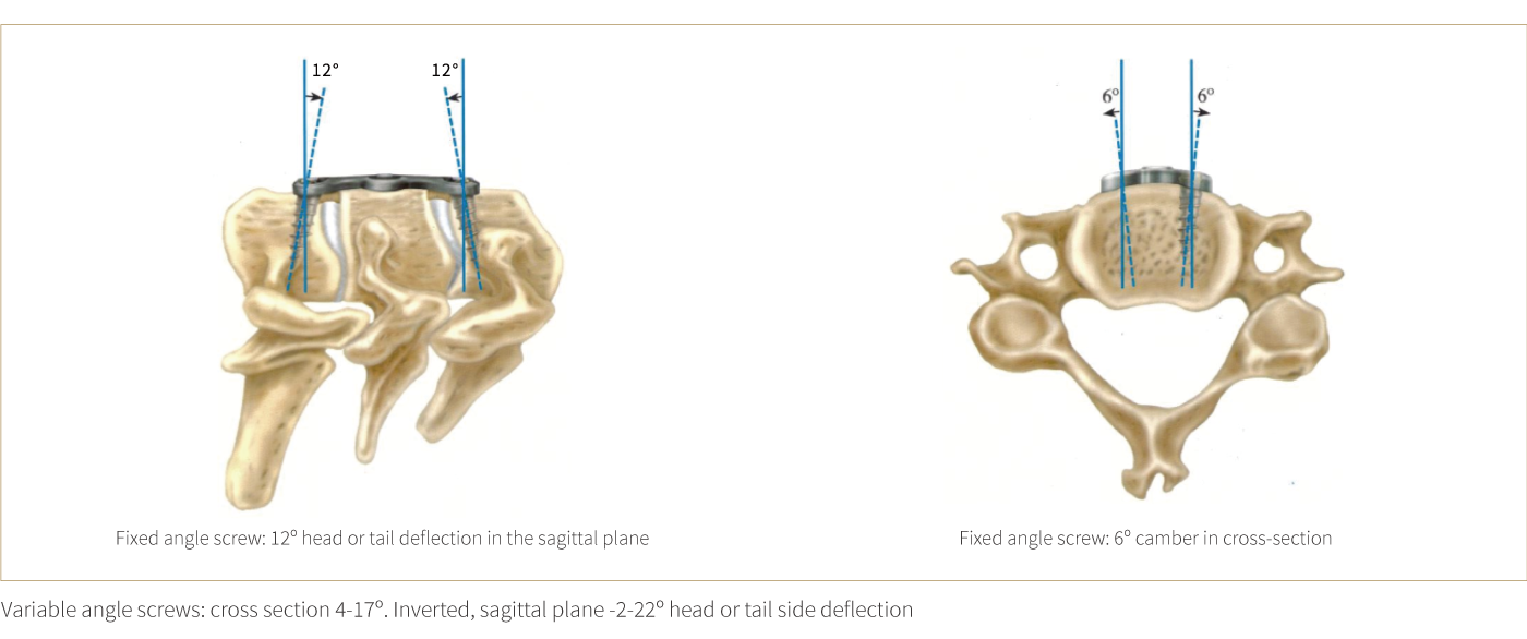 Anterior Cervical Plate – Type III Anterior Cervical Plate – Type III
