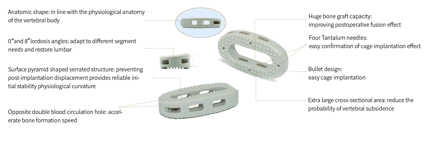 Oblique Lateral Interbody Fusion Cage LF-IV Oblique Lateral Interbody Fusion Cage LF-IV