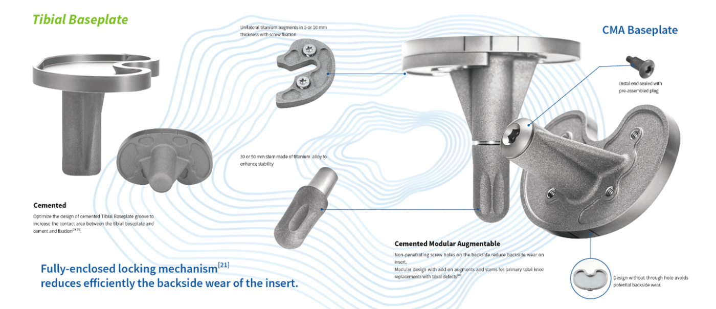 Mobile Bearing (MB) rotating knee replacement,rotating platform total knee replacement Mobile Bearing (MB) rotating knee replacement,rotating platform total knee replacement