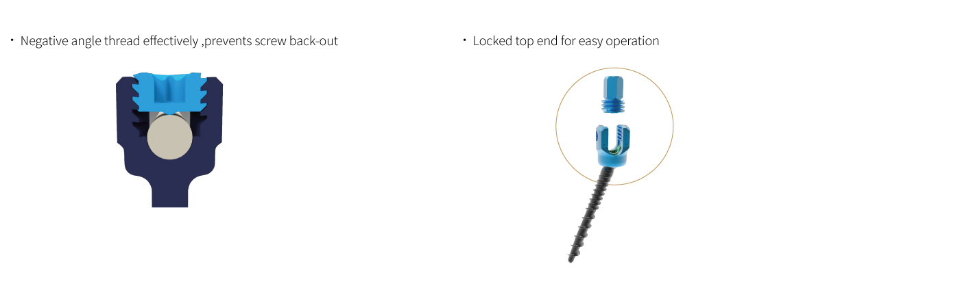Posterior Thoracolumbar Spinal System 5.5
