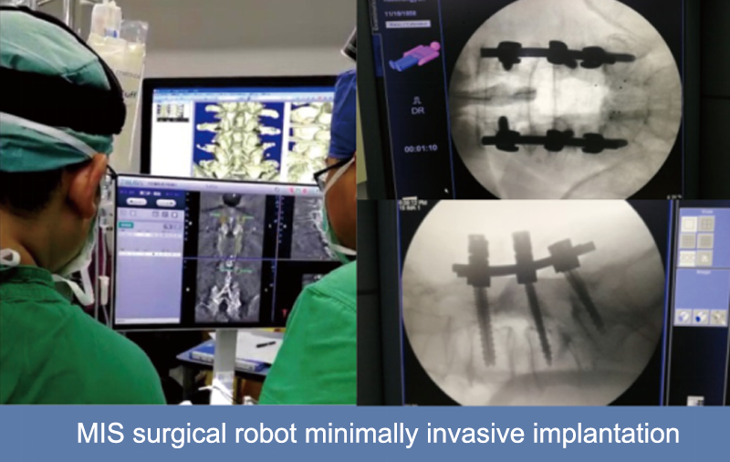 orthopedic surgical robot orthopedic surgical robot