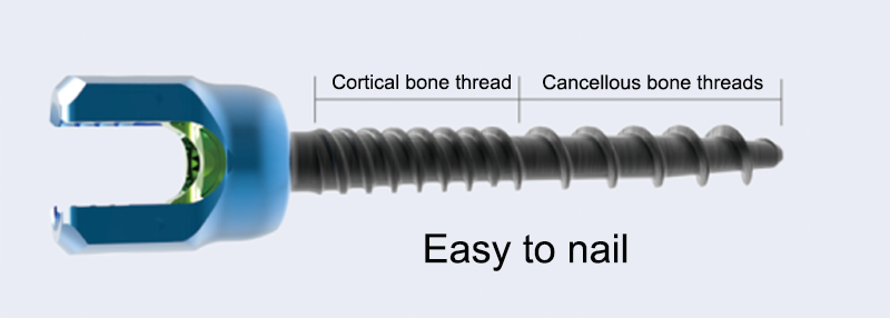 Screw Thread Cortical Bone / Cancellous Bone Dual Thread Screw Thread Cortical Bone / Cancellous Bone Dual Thread