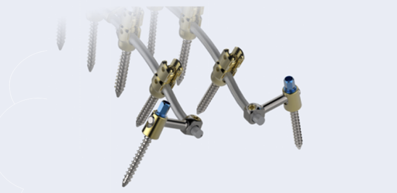 Thoracolumbar Percutaneous Screw & Rod System - Sacroiliac Thoracolumbar Percutaneous Screw & Rod System - Sacroiliac