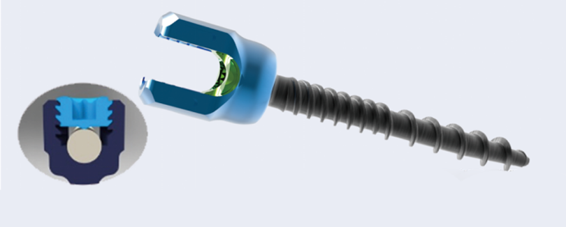 negative-angle thread design screw negative-angle thread design screw