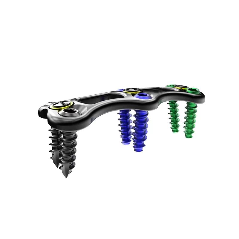 What Factors Determine the Stability of Cervical Spine Implants? What Factors Determine the Stability of Cervical Spine Implants?
