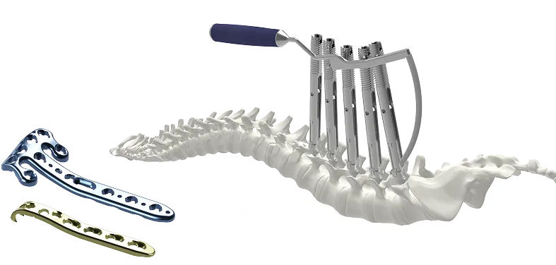 Looking for a Reliable Orthopedic Implants Supplier?