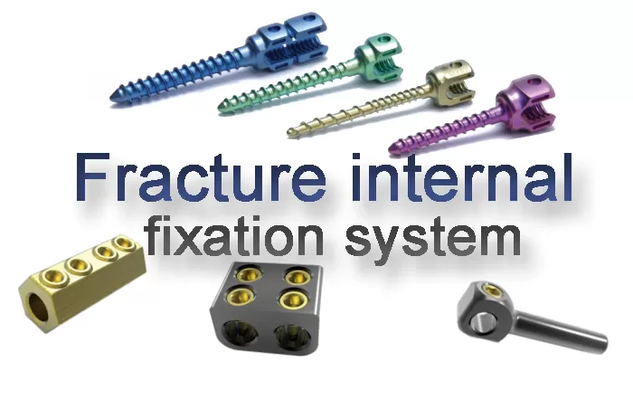 Fracture internal fixation system